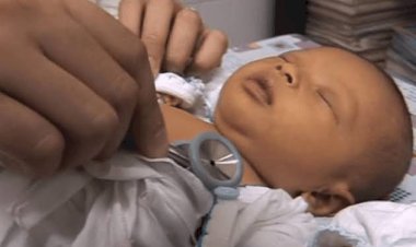 Pemerintah Lakukan Investigasi Kontak 3 Kasus Hepatitis Akut Pada Anak