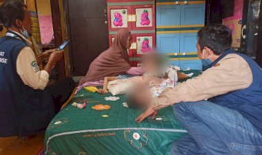 Alami Kelainan Kebutuhan Khusus, Dua Anak Asal Depok Butuh Bantuan