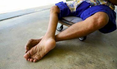 Pemdaprov Waspadai Penyebaran Polio