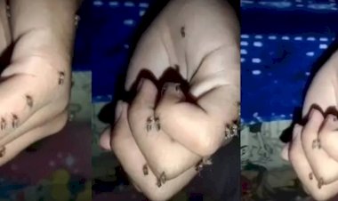 Viral Orang Ini Digigit Puluhan Nyamuk saat Tidur, Disebut Donor Darah