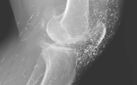 X-Ray Bongkar Ratusan Benang Emas di Lutut Wanita Korea, Netizen Syok!