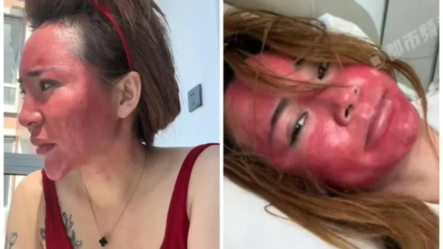 Wanita Ini Mengaku Tak Pernah Hapus Makeup Selama 22 Tahun: Wajah Rusak dan Membengkak
